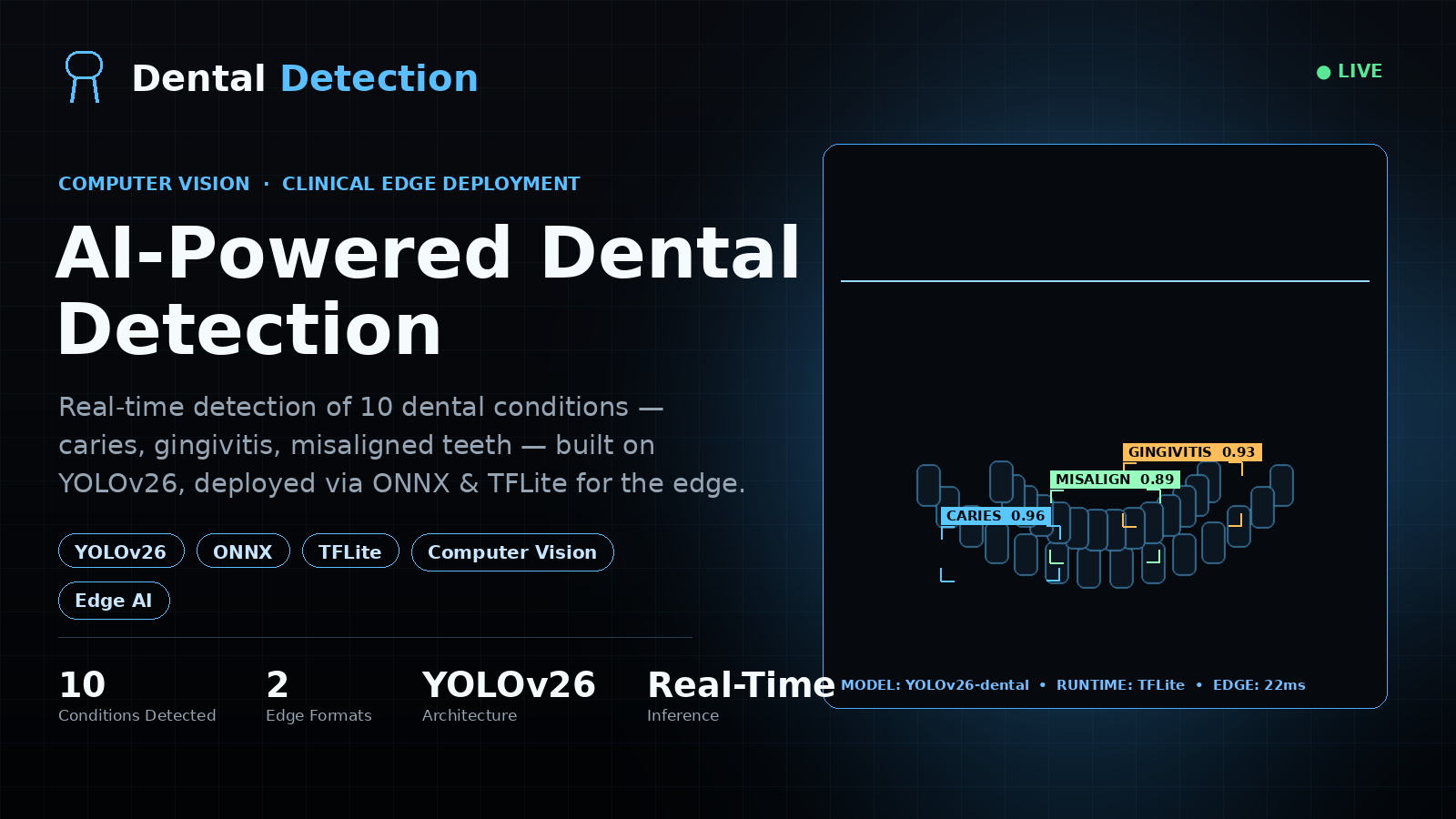 Dental Detection